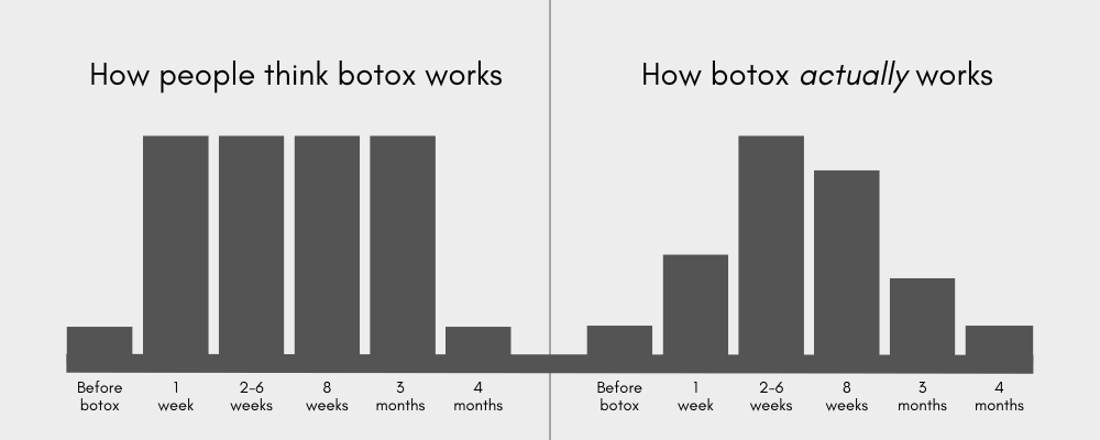 Botox longevity infographic