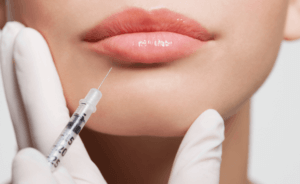 Woman getting lip injections