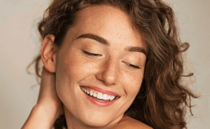 Woman smiling after skinpen treatment