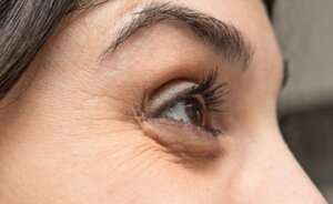 Up close picture of woman with tired eyes in Suffolk