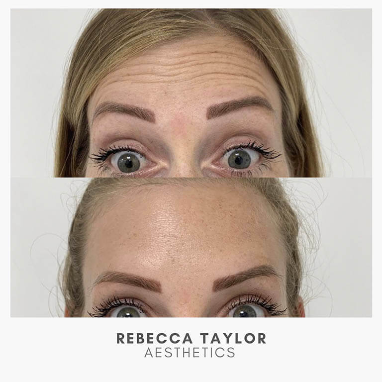 Rebecca Taylor Aesthetics Clinic in Suffolk