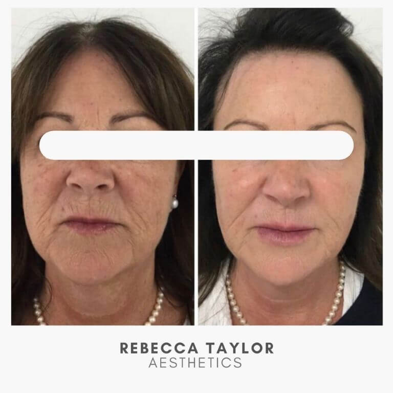 Rebecca Taylor Aesthetics Clinic in Suffolk