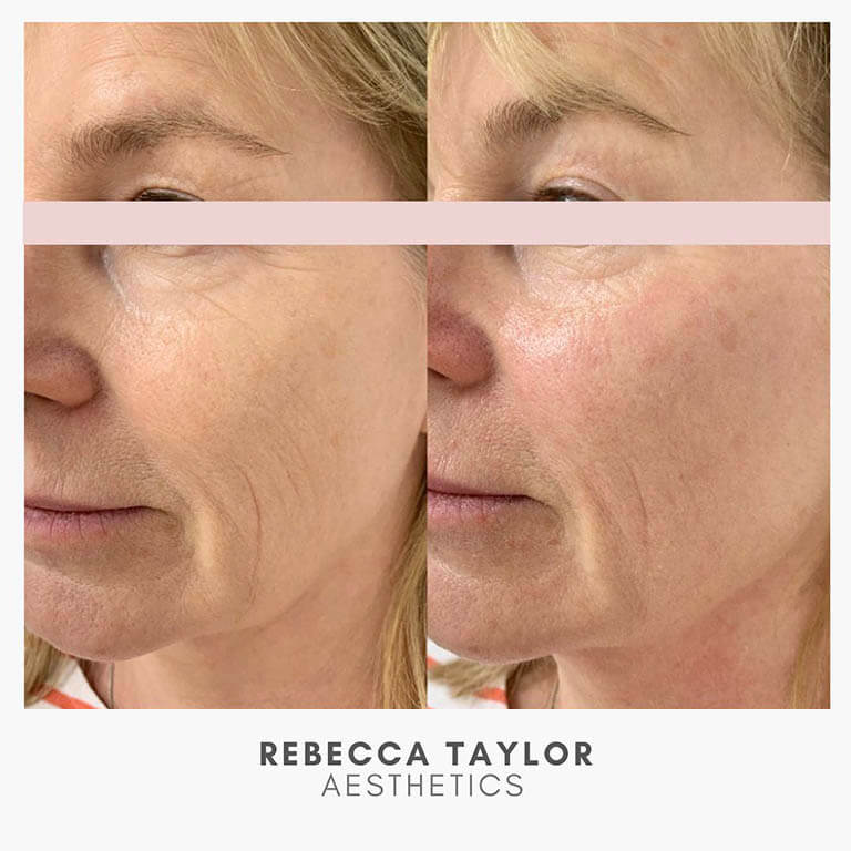 Rebecca Taylor Aesthetics Clinic in Suffolk