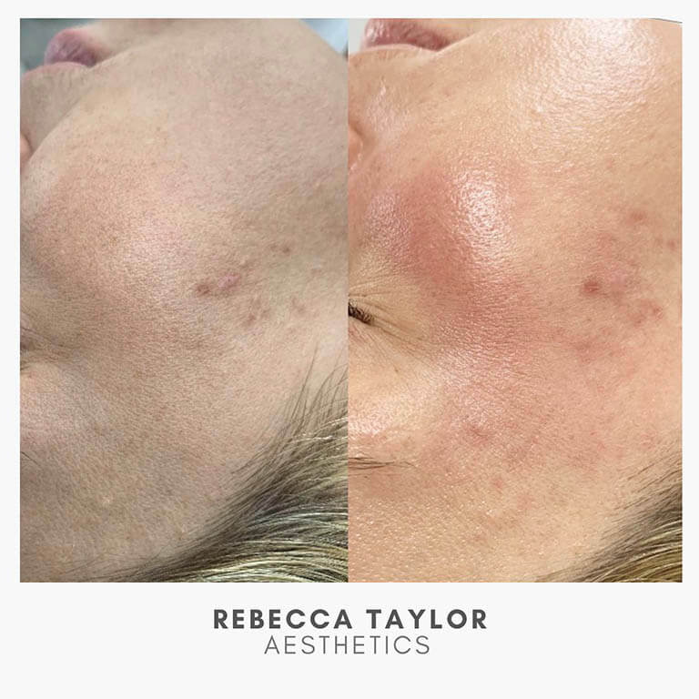 Rebecca Taylor Aesthetics Clinic in Suffolk