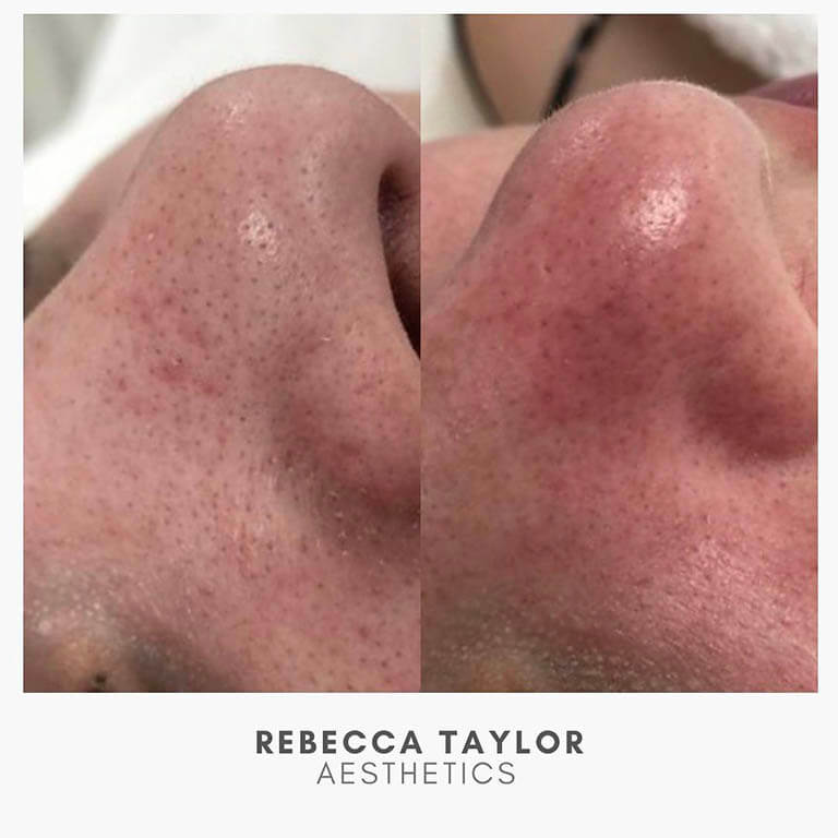 Rebecca Taylor Aesthetics Clinic in Suffolk