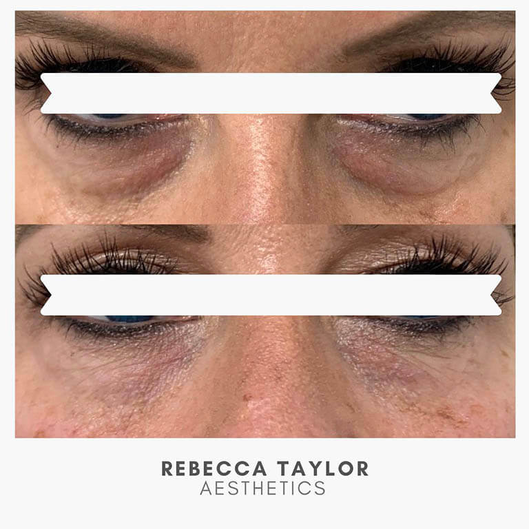 Rebecca Taylor Aesthetics Clinic in Suffolk