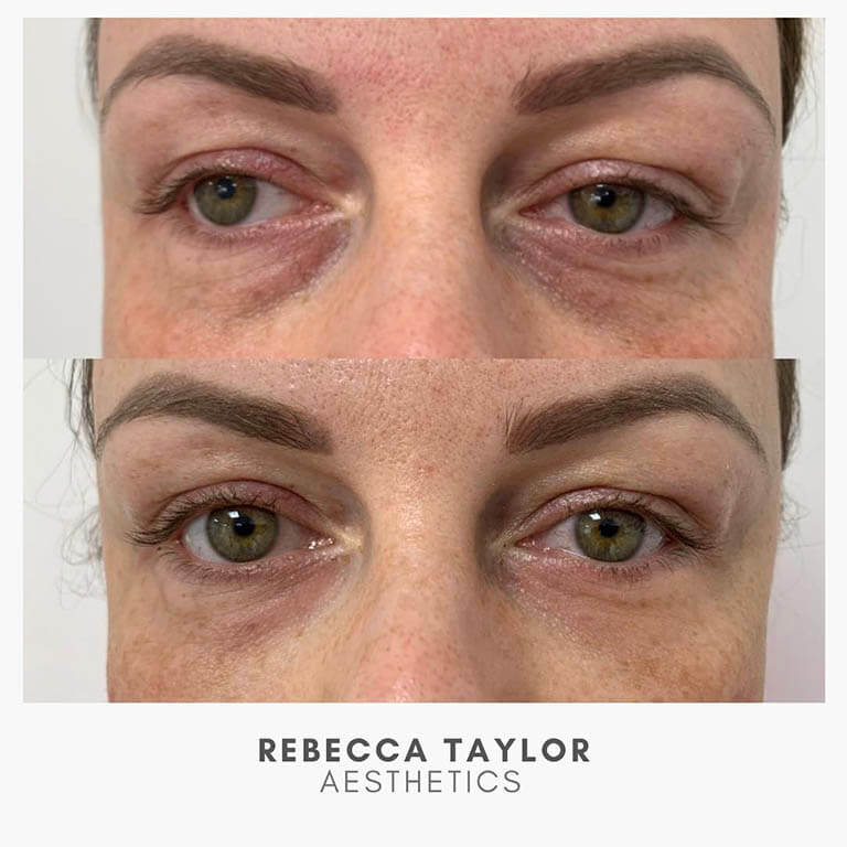 Rebecca Taylor Aesthetics Clinic in Suffolk