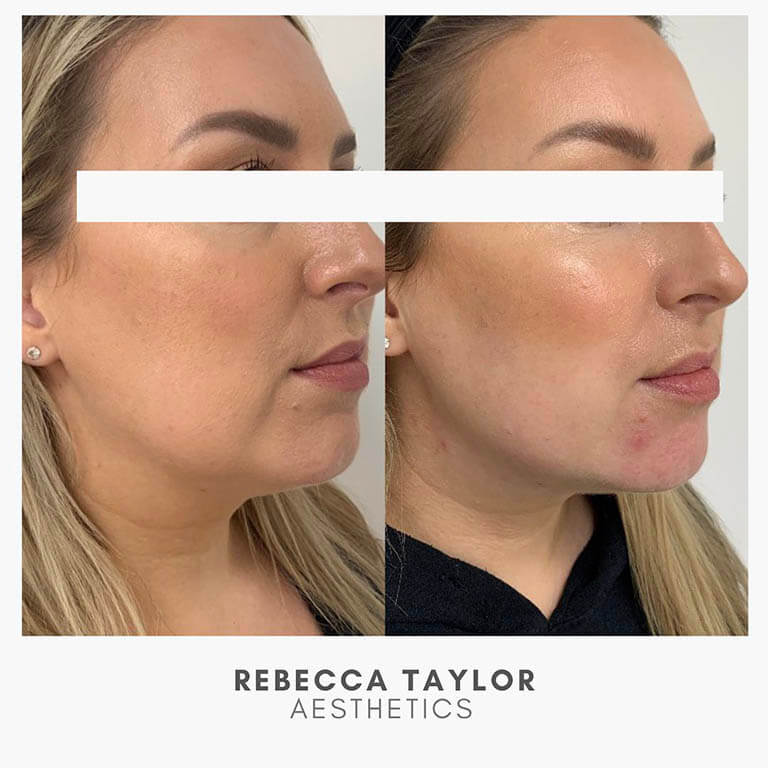 Rebecca Taylor Aesthetics Clinic in Suffolk