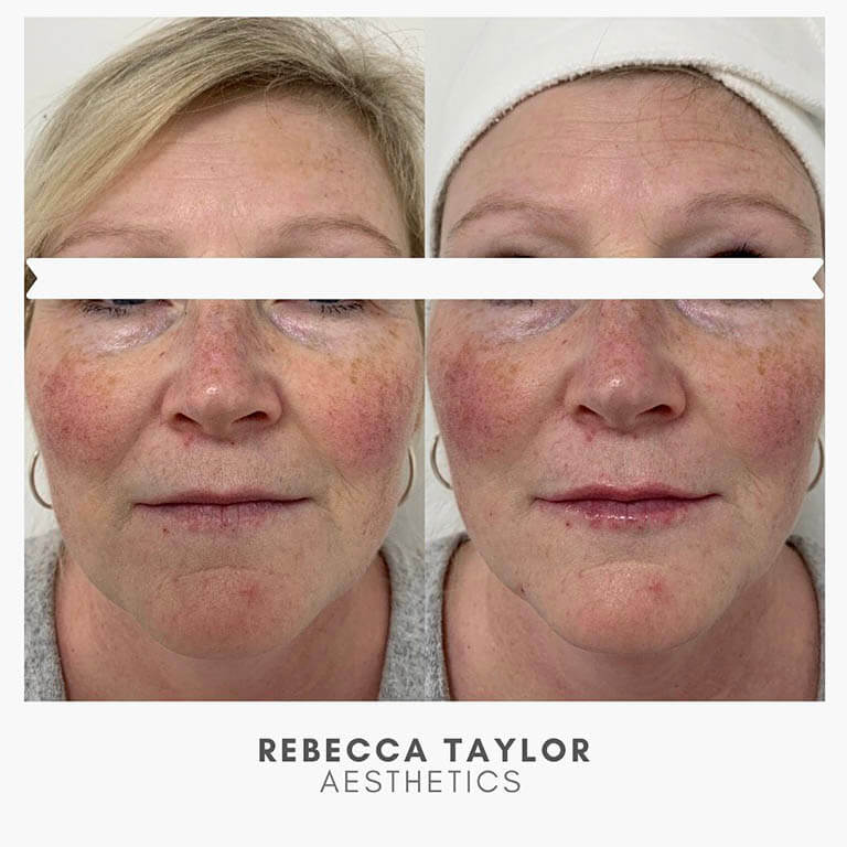 Rebecca Taylor Aesthetics Clinic in Suffolk