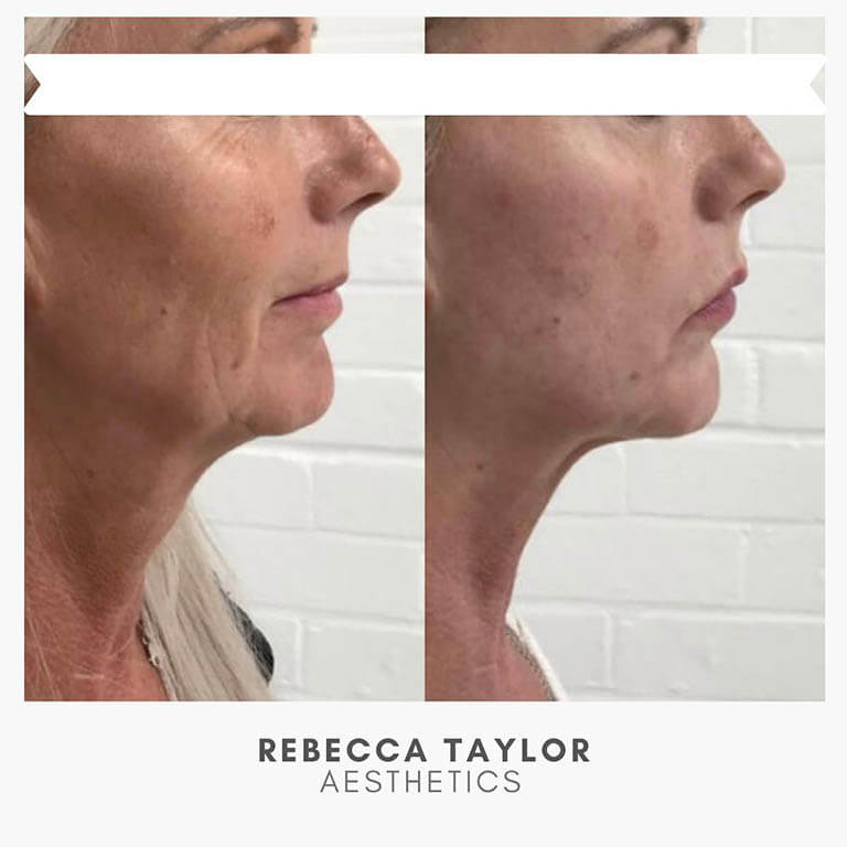 Rebecca Taylor Aesthetics Clinic in Suffolk