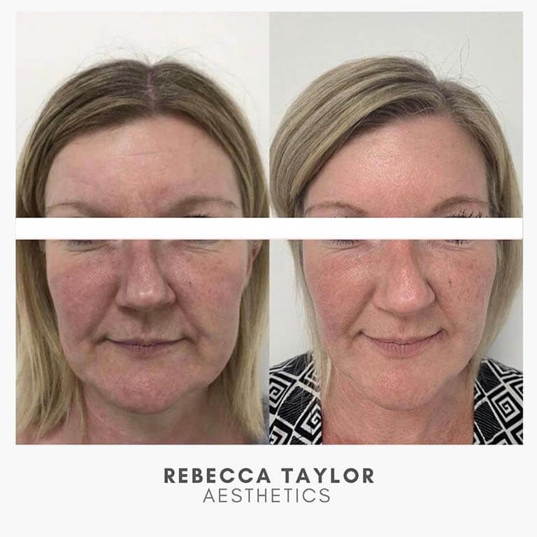 Rebecca Taylor Aesthetics Clinic in Suffolk