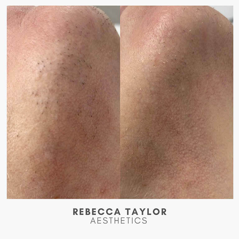 Rebecca Taylor Aesthetics Clinic in Suffolk