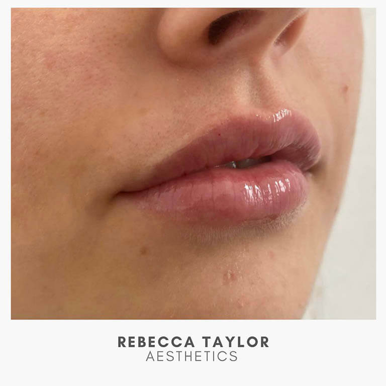 Rebecca Taylor Aesthetics Clinic in Suffolk