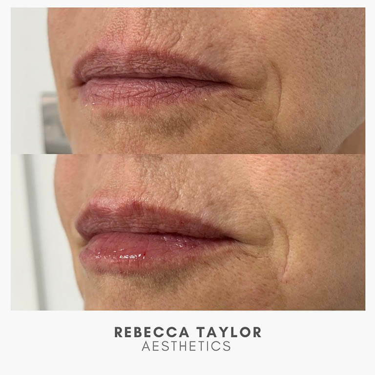 Rebecca Taylor Aesthetics Clinic in Suffolk