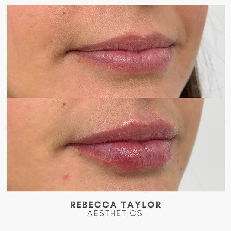 Rebecca Taylor Aesthetics Clinic in Suffolk