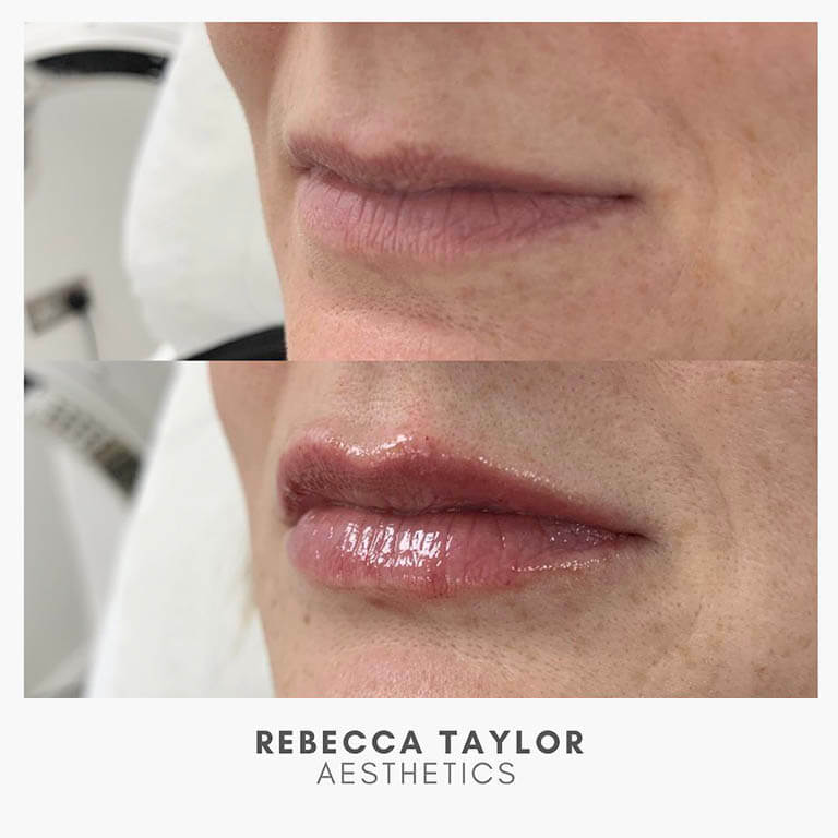 Rebecca Taylor Aesthetics Clinic in Suffolk