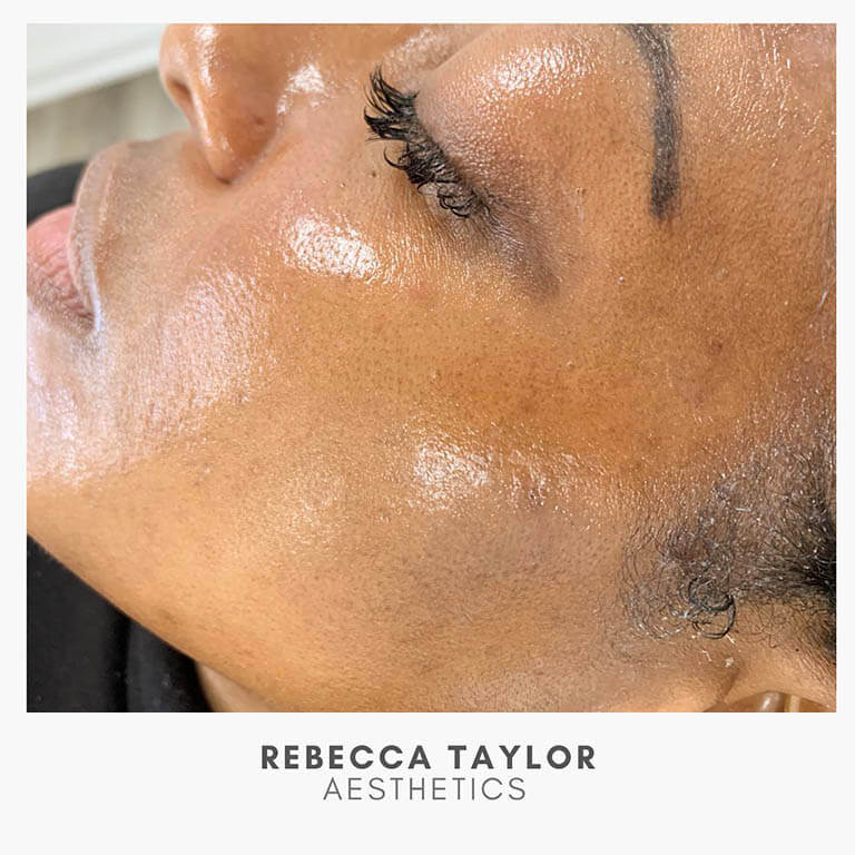 Rebecca Taylor Aesthetics Clinic in Suffolk