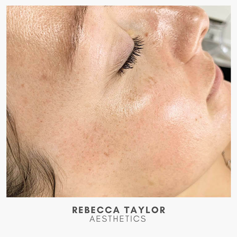 Rebecca Taylor Aesthetics Clinic in Suffolk