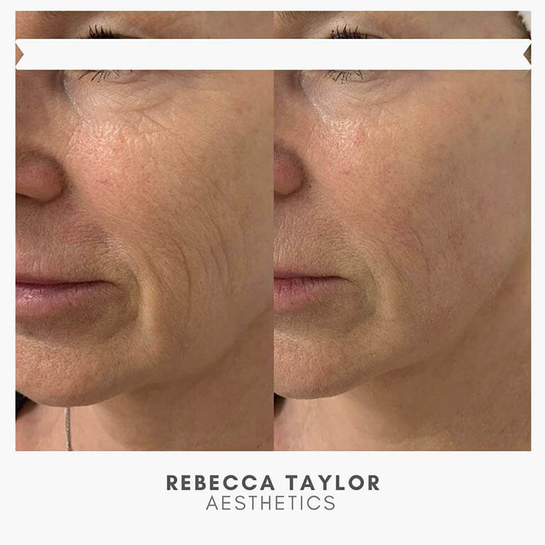 Rebecca Taylor Aesthetics Clinic in Suffolk