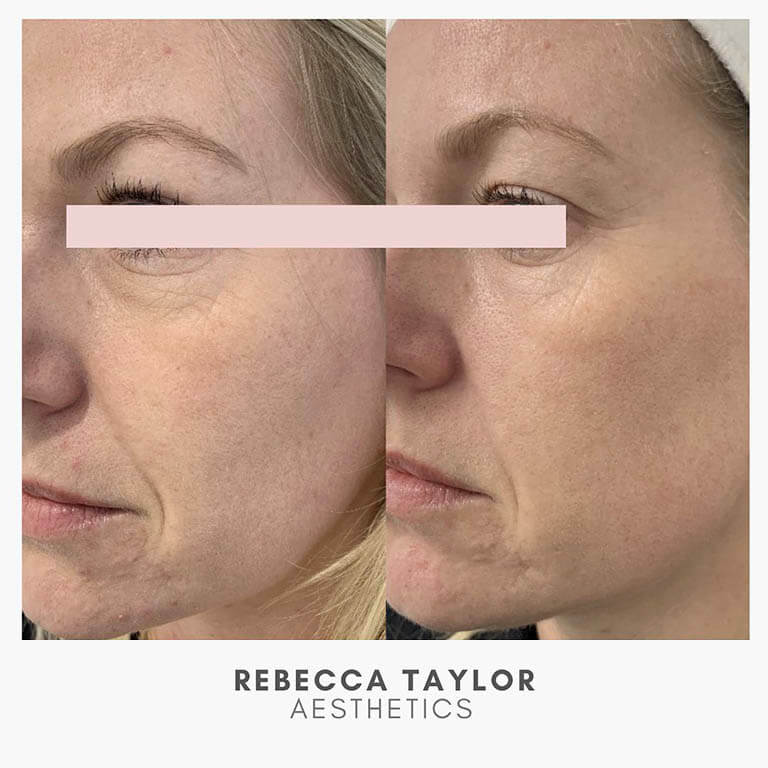 Rebecca Taylor Aesthetics Clinic in Suffolk