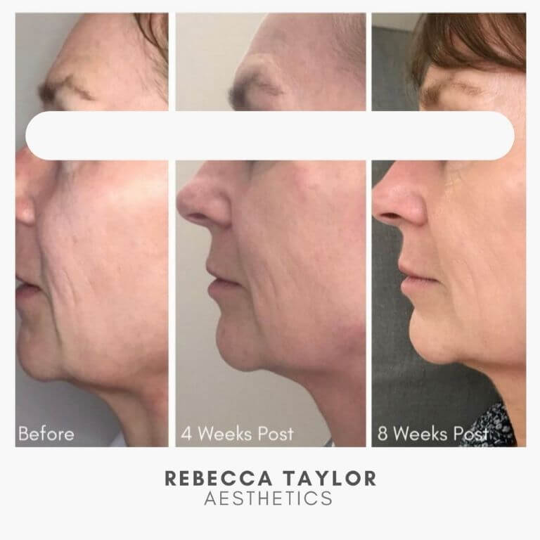 Rebecca Taylor Aesthetics Clinic in Suffolk