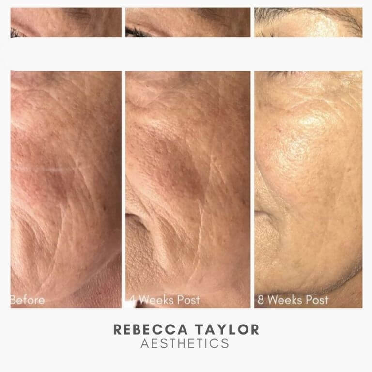 Rebecca Taylor Aesthetics Clinic in Suffolk