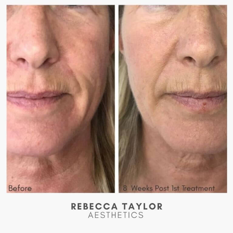 Rebecca Taylor Aesthetics Clinic in Suffolk