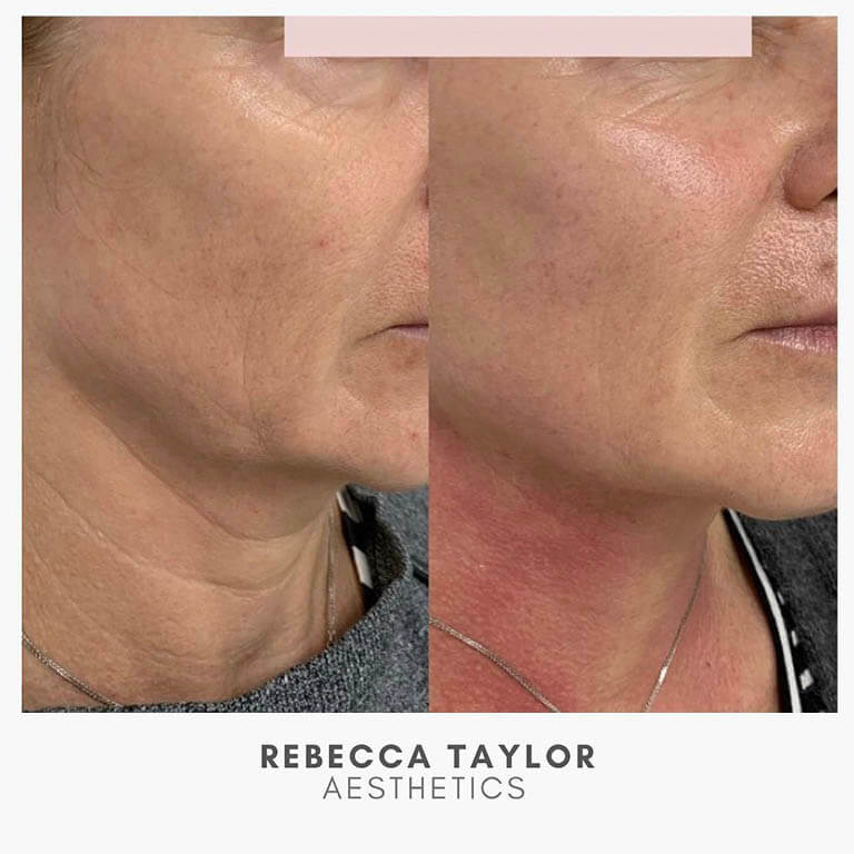 Rebecca Taylor Aesthetics Clinic in Suffolk