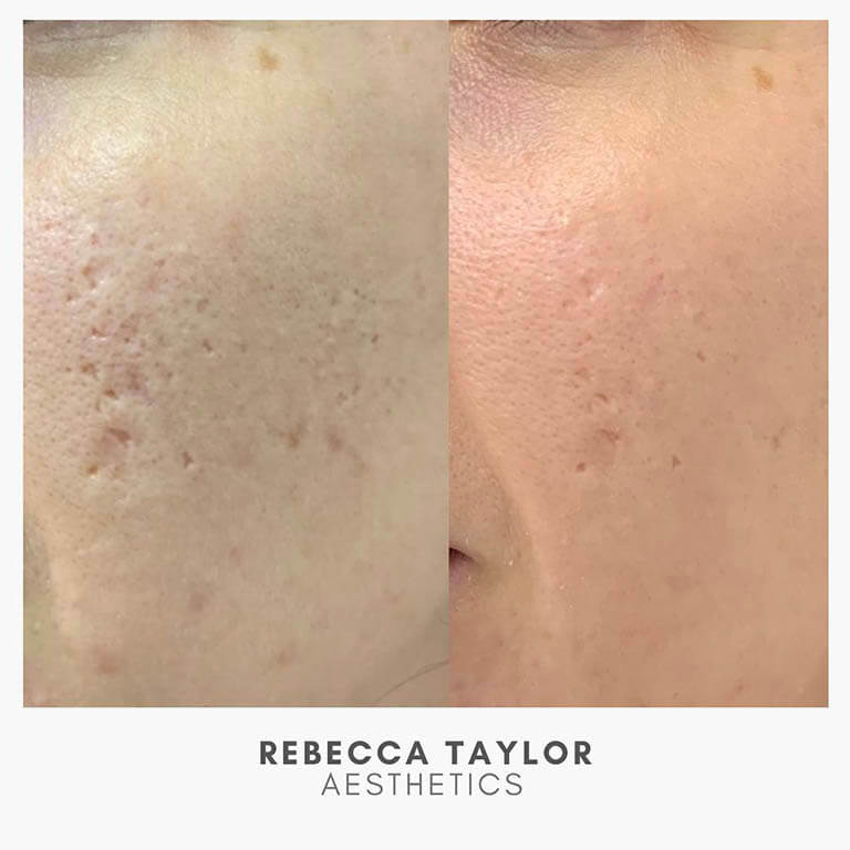 Rebecca Taylor Aesthetics Clinic in Suffolk