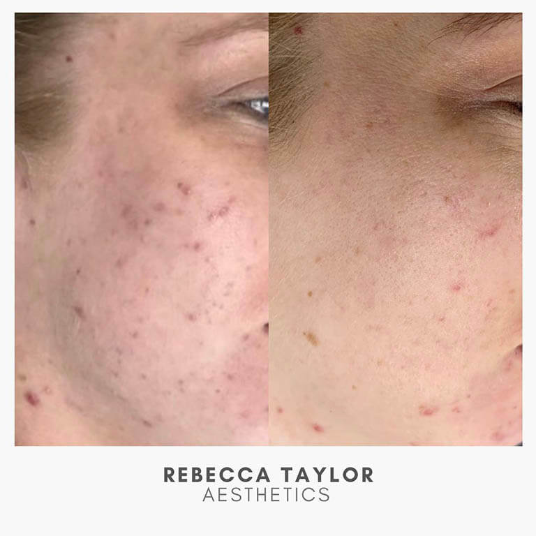 Rebecca Taylor Aesthetics Clinic in Suffolk