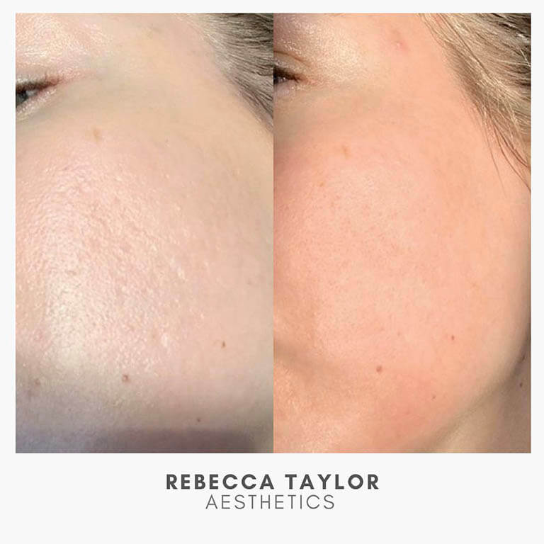 Rebecca Taylor Aesthetics Clinic in Suffolk