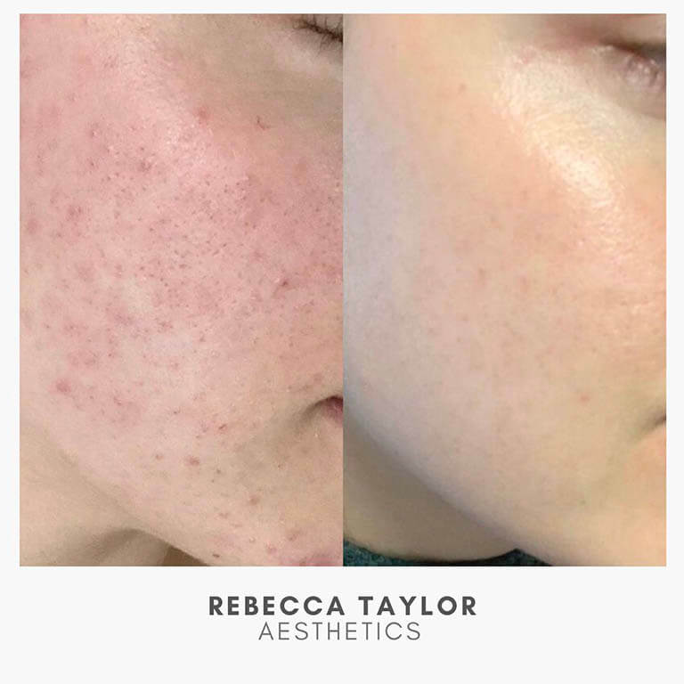 Rebecca Taylor Aesthetics Clinic in Suffolk