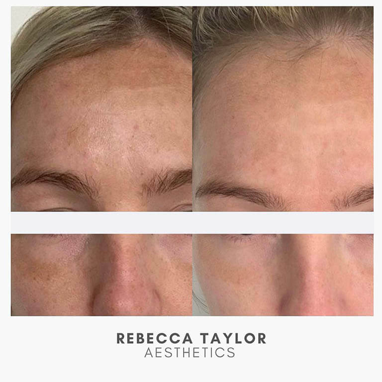 Rebecca Taylor Aesthetics Clinic in Suffolk