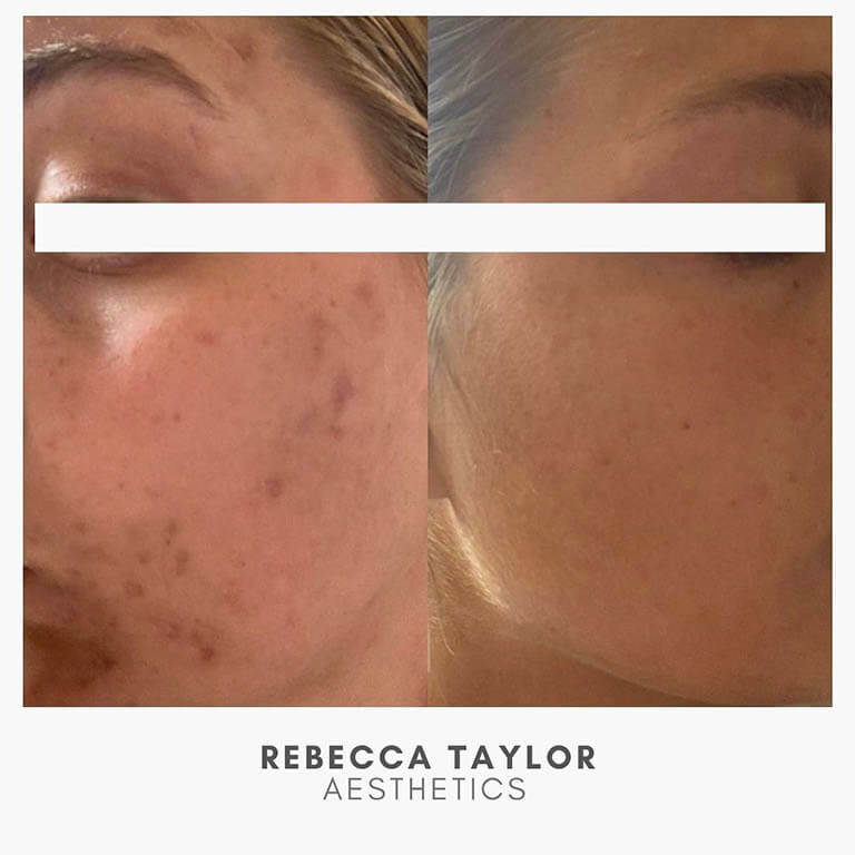 Rebecca Taylor Aesthetics Clinic in Suffolk