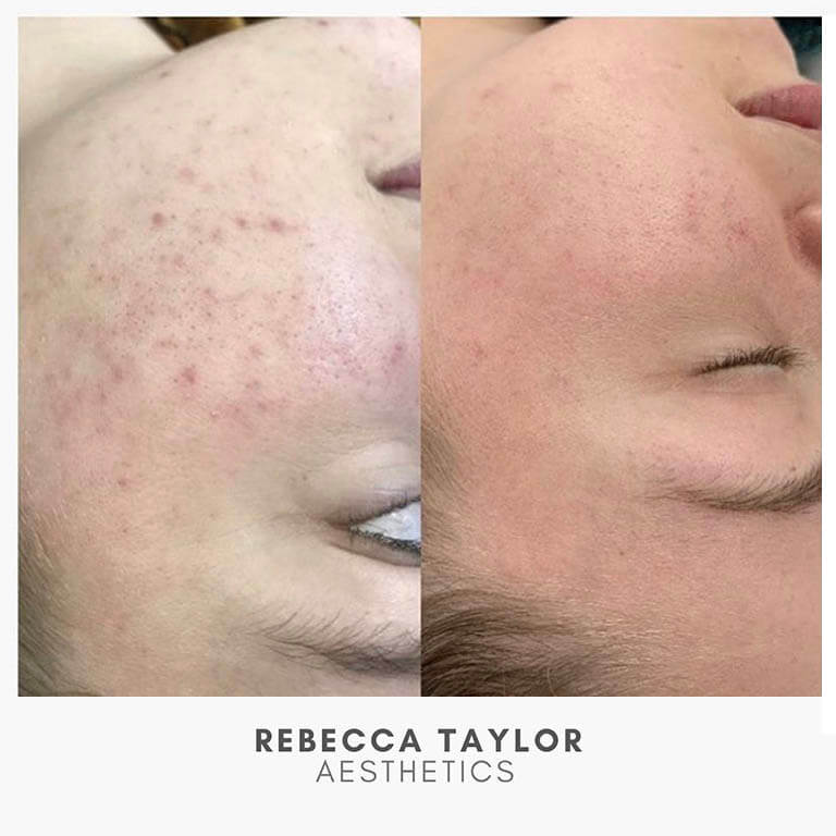 Rebecca Taylor Aesthetics Clinic in Suffolk