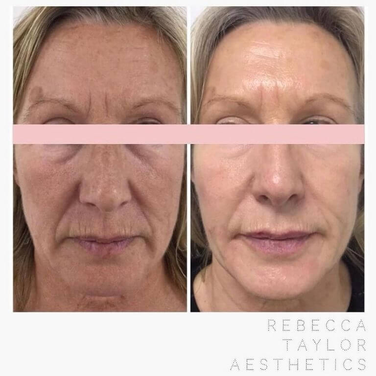 Rebecca Taylor Aesthetics Clinic in Suffolk