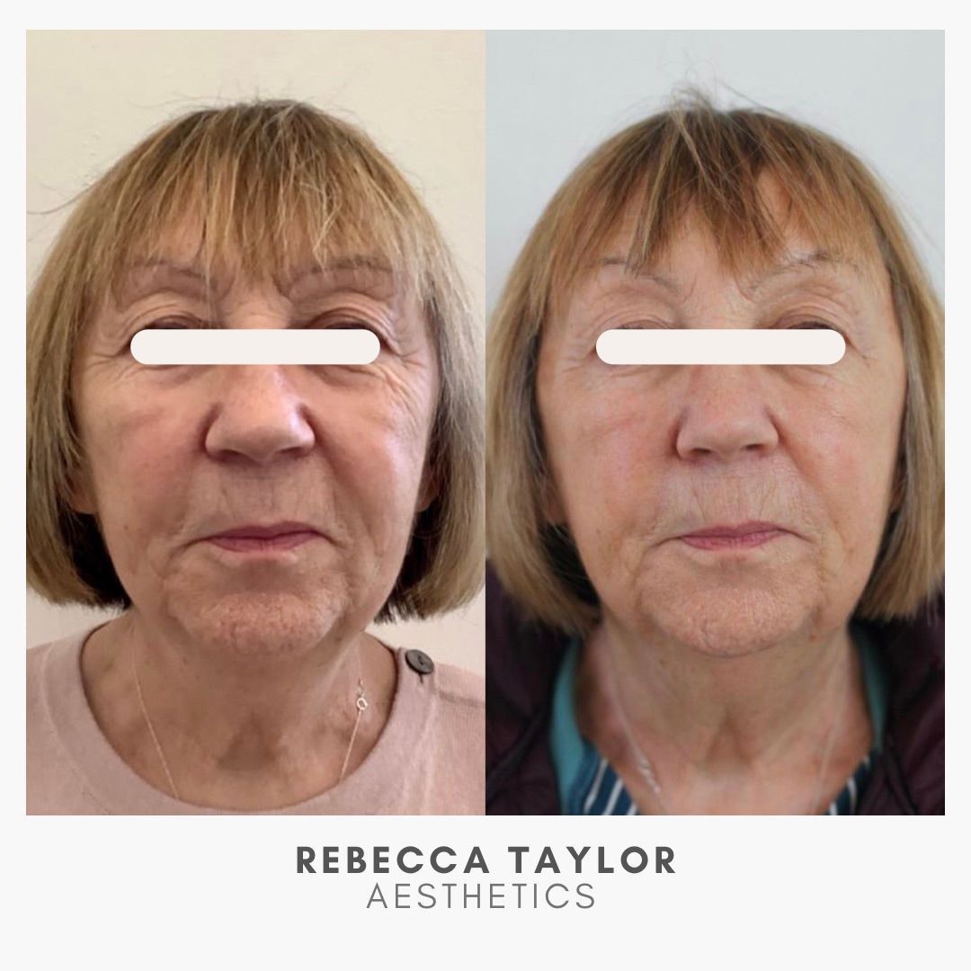 Rebecca Taylor Aesthetics Clinic in Suffolk