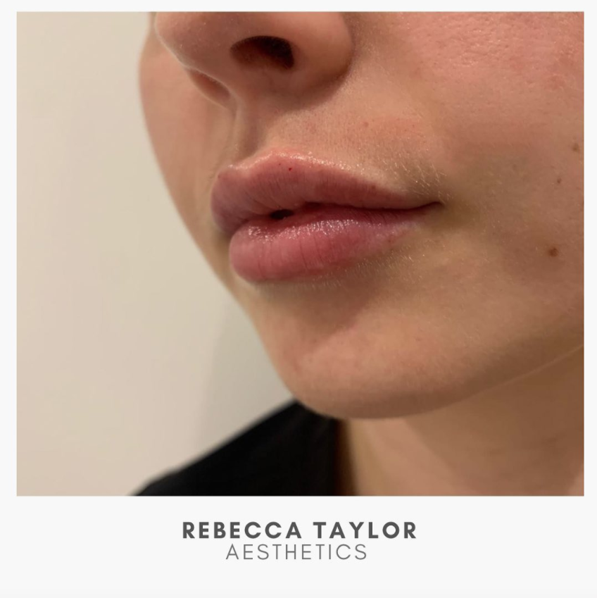 Rebecca Taylor Aesthetics Clinic in Suffolk