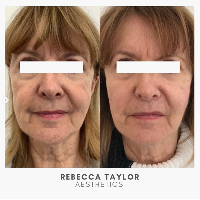 Rebecca Taylor Aesthetics Clinic in Suffolk