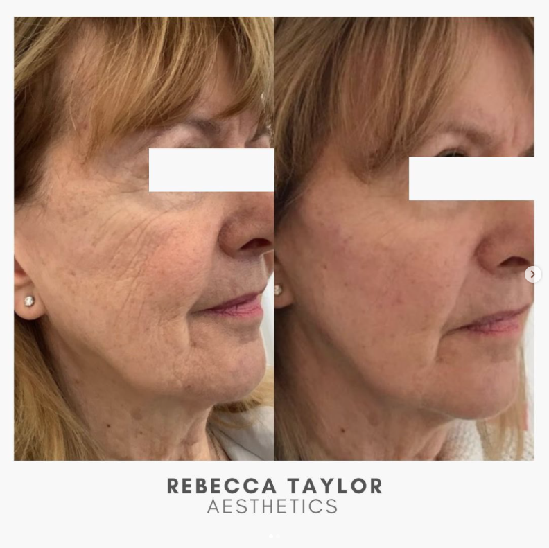 Rebecca Taylor Aesthetics Clinic in Suffolk