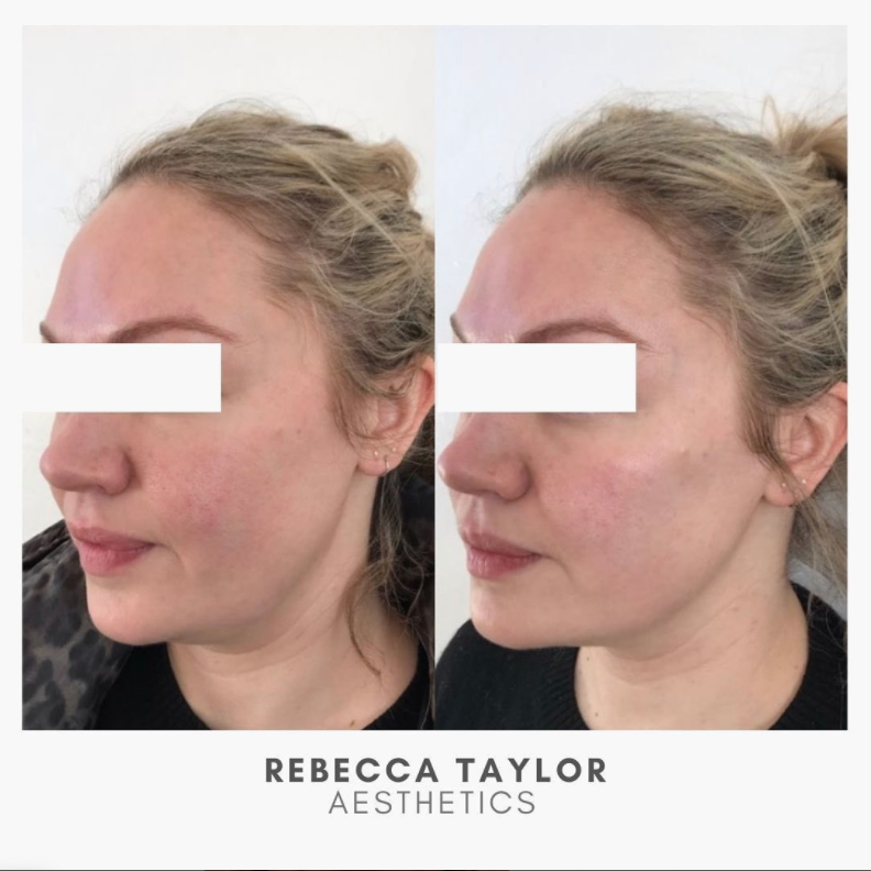 Rebecca Taylor Aesthetics Clinic in Suffolk