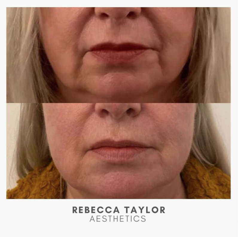 Rebecca Taylor Aesthetics Clinic in Suffolk