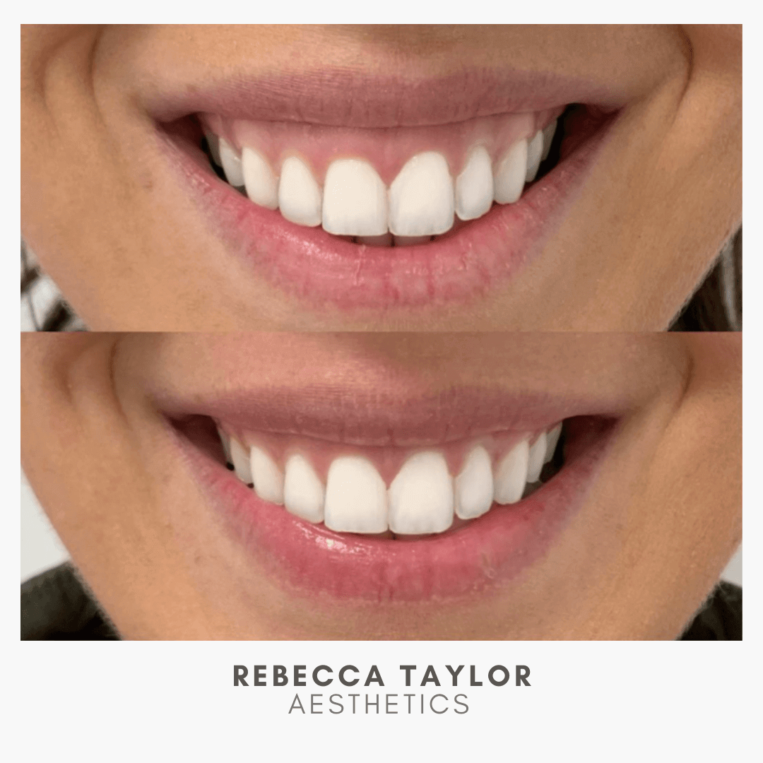 Rebecca Taylor Aesthetics Clinic in Suffolk