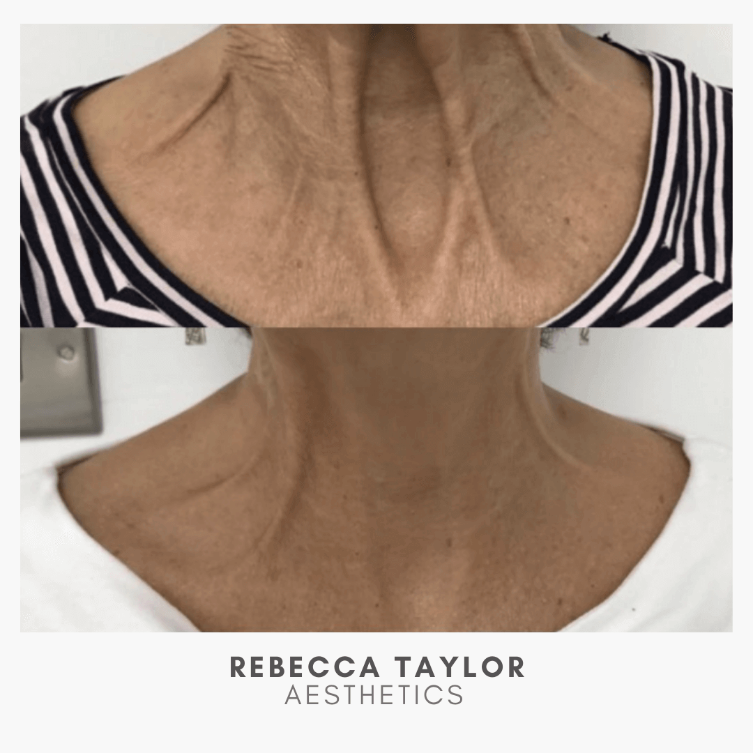 Rebecca Taylor Aesthetics Clinic in Suffolk