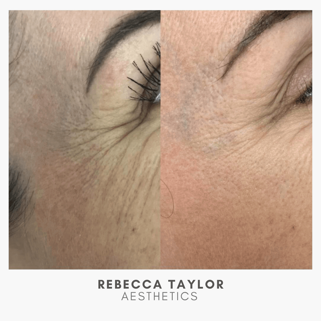 Rebecca Taylor Aesthetics Clinic in Suffolk