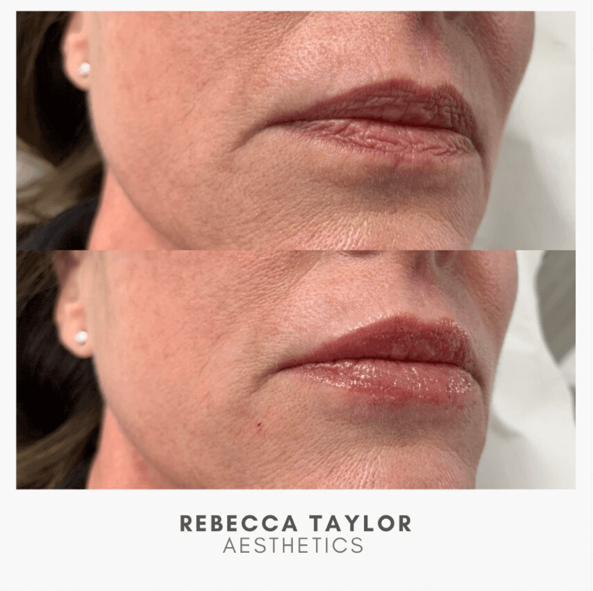 Rebecca Taylor Aesthetics Clinic in Suffolk