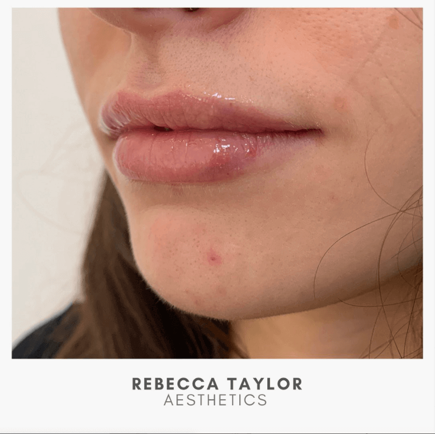 Rebecca Taylor Aesthetics Clinic in Suffolk