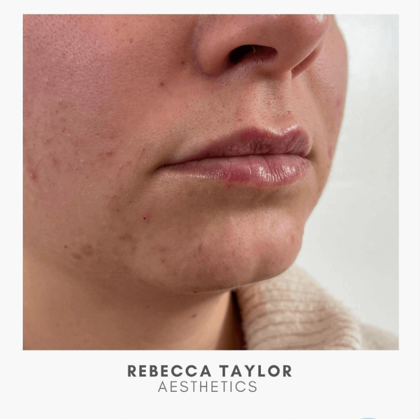 Rebecca Taylor Aesthetics Clinic in Suffolk