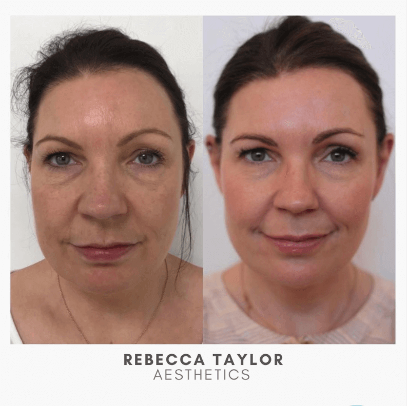 Facial Treatments Suffolk | Facials Suffolk | Aesthetics Clinic Suffolk