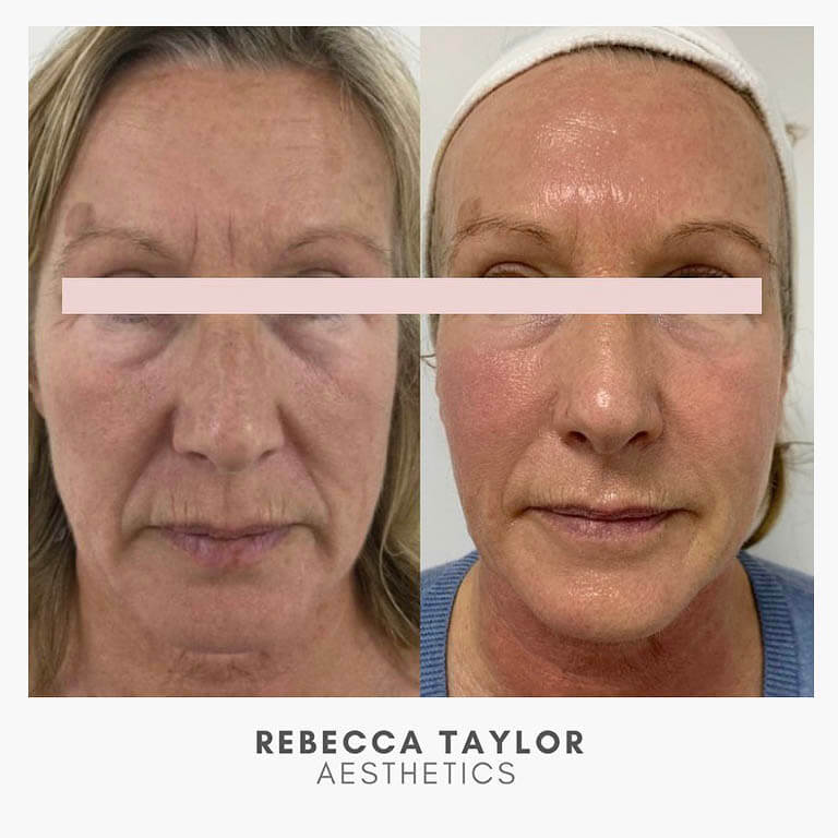 Rebecca Taylor Aesthetics Clinic in Suffolk